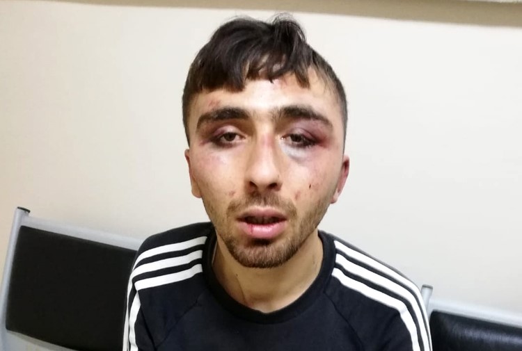 B.Y. alleges that in December 2019 police detained him and beat him while they were transferring him to a police station. © 2019 Private