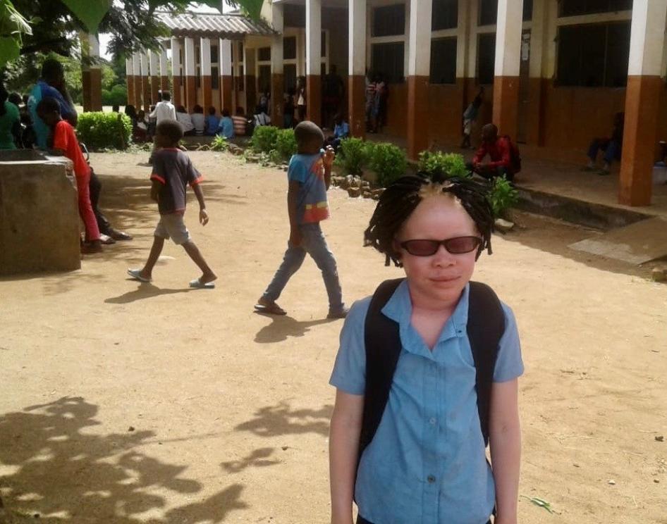 Josina porte ses nouvelles lunettes correctrices devant son école dans le district de Chiuta (province de Tete) au Mozambique, en 2019. Ces lunettes, cruciales pour corriger la déficience visuelle liée à l’albinisme dont elle est atteinte , ont permis à Josina d’obtenir de meilleurs notes avant la fermeture provisoire de son école en 2020, en raison de la pandémie de Covid-19. 