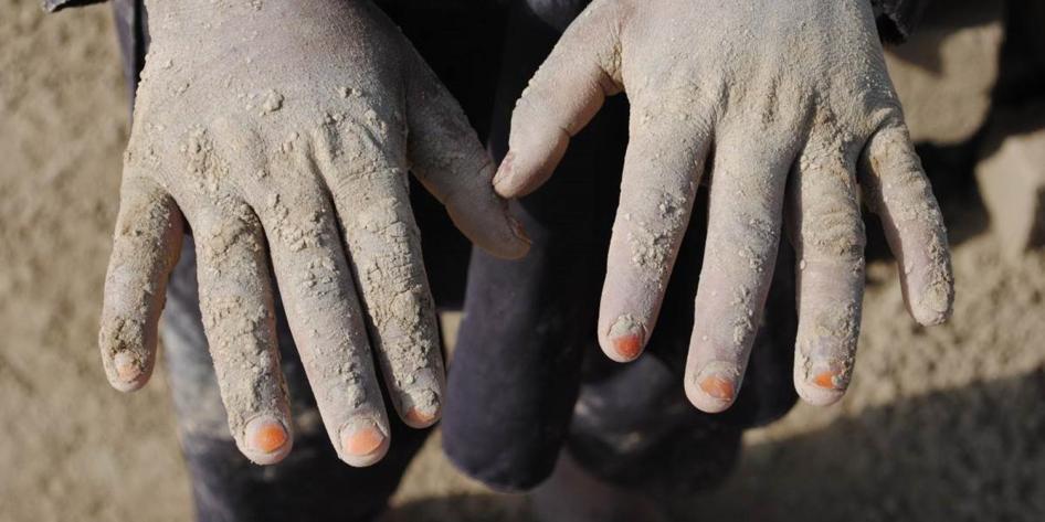 Helal, un jeune garçon afghan âgé de 10 ans qui passe ses journées à travailler dans une briqueterie près de Kaboul, montre ses mains recouvertes d’argile
