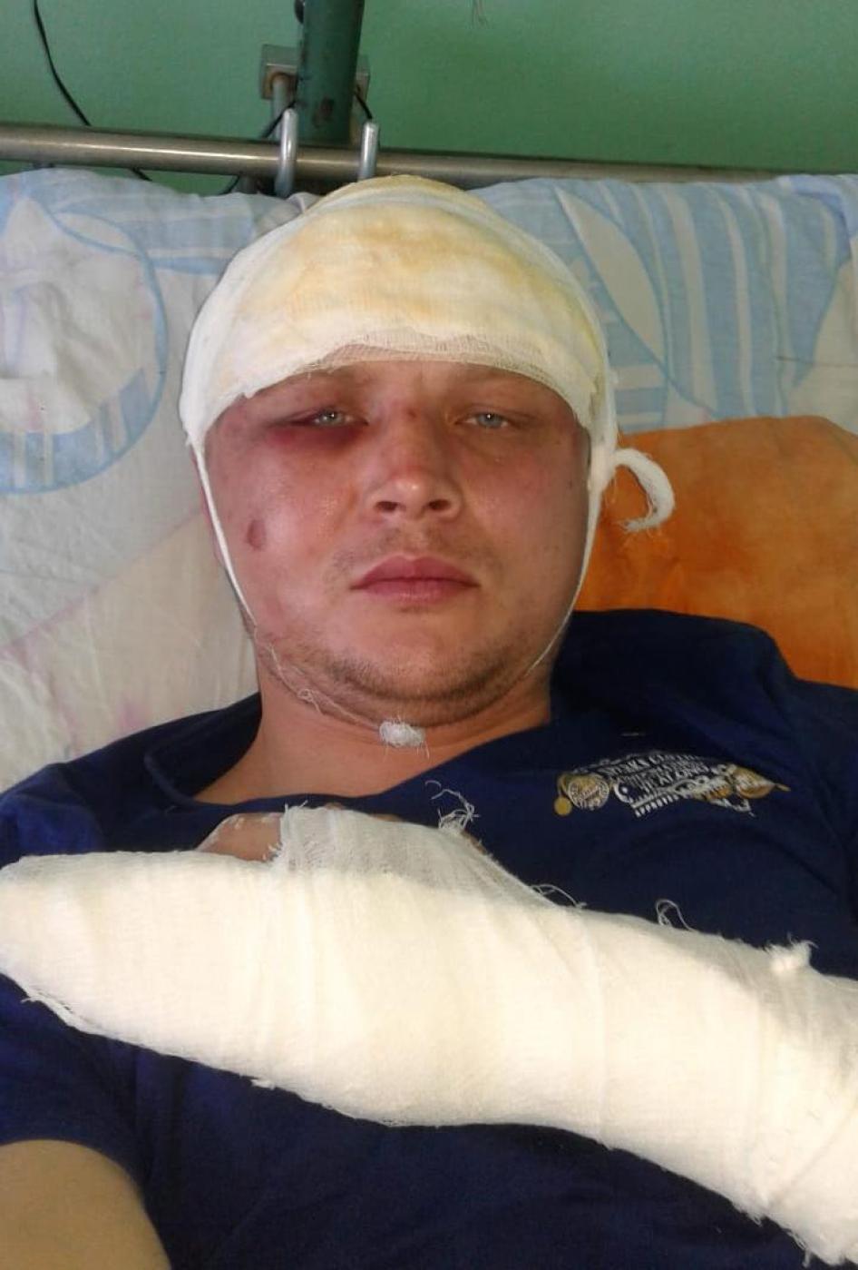 Профсоюзный лидер Дмитрий Сенявский в больнице 11 ноября 2018 г. – на следующий день после нападения. 