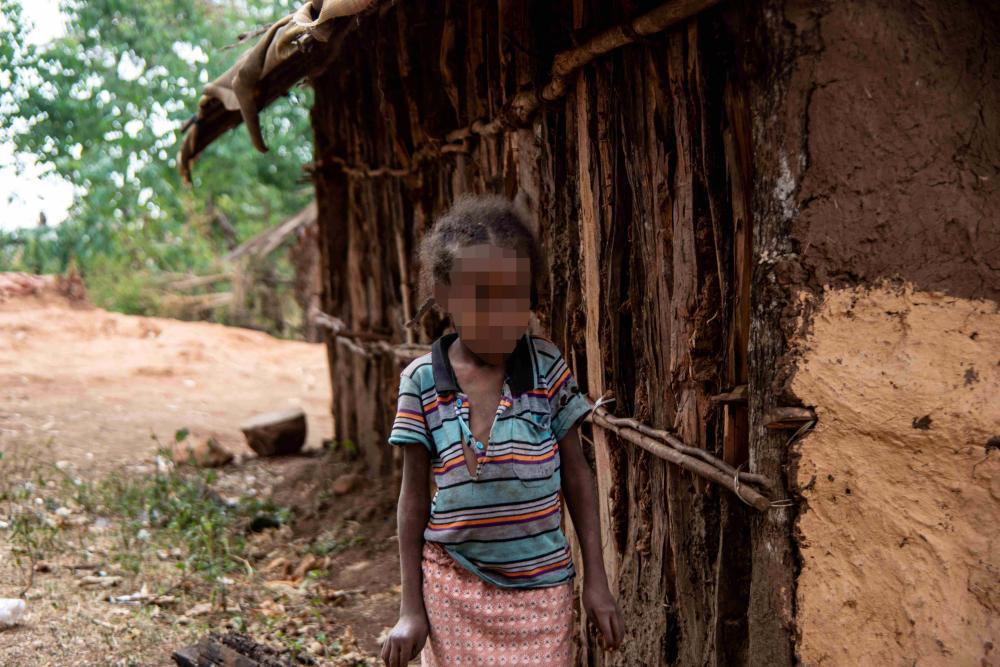A 7-year-old girl with a physical disability living near Lega Dembi gold mine, Oromia region, Ethiopia.