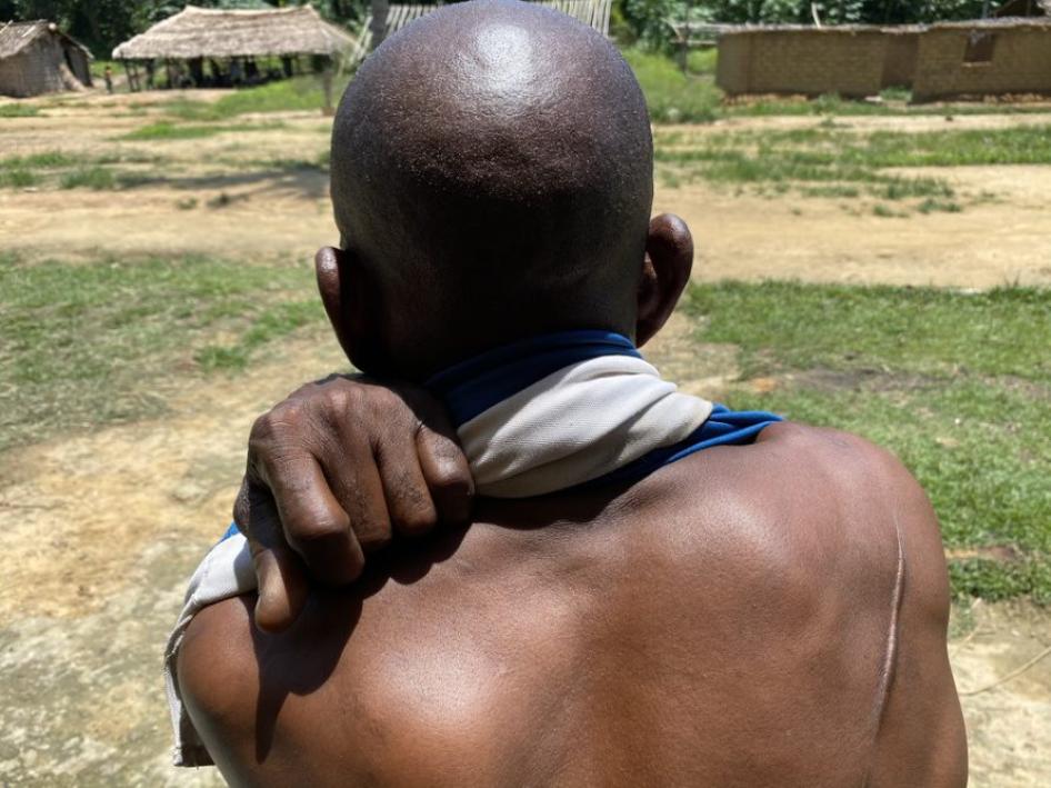 Un homme autochtone Iyeke montre la cicatrice d’une blessure par un coup de machette à Sambwakoy, dans la province de la Tshuapa, en République démocratique du Congo, en octobre 2021. 