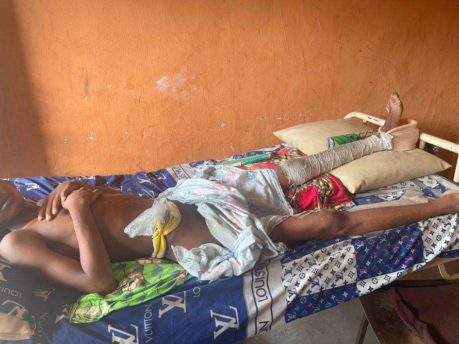 A 19-year-old survivor of the airstrike with multiple injuries, including a broken tibia bone and deep flesh wounds receiving care in a private hospital in Lafia, Nasarawa state, Nigeria, after surgery. Photo taken on March 15, 2023.