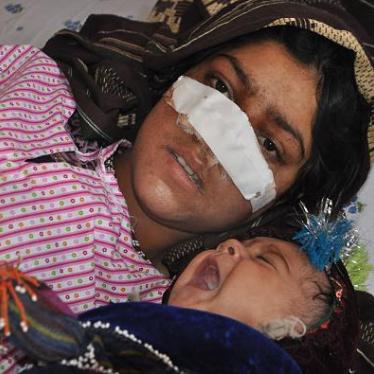 Afghan woman Raiza Gul, 20, and whose nose was sliced off by her husband in an attack, lies on a bed with her baby as she receives treatment at a hospital in the northern province of Faryab on January 19, 2016.